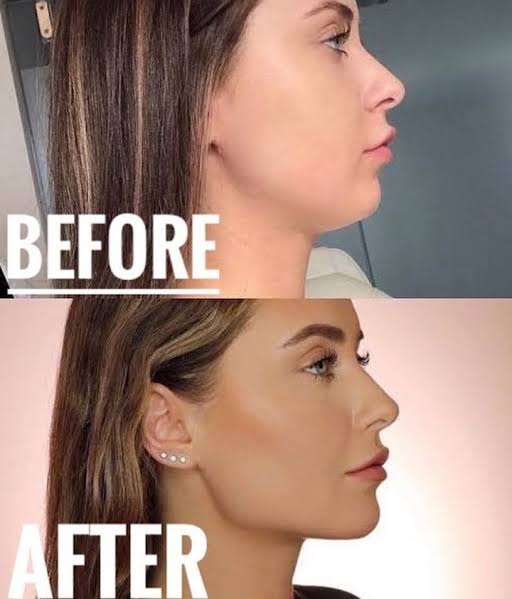 Jaw Fitness Tool for Face Toning - Make your face look awesome